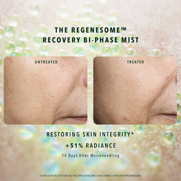 REGENESOME™ PROCEDURE OPTIMIZER KIT