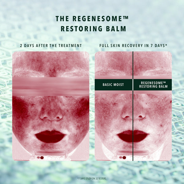 REGENESOME™ PROCEDURE OPTIMIZER KIT