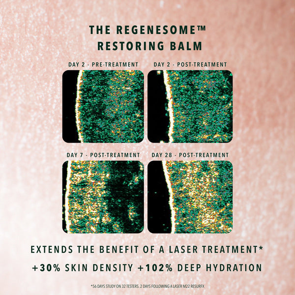 REGENESOME™ PROCEDURE OPTIMIZER KIT